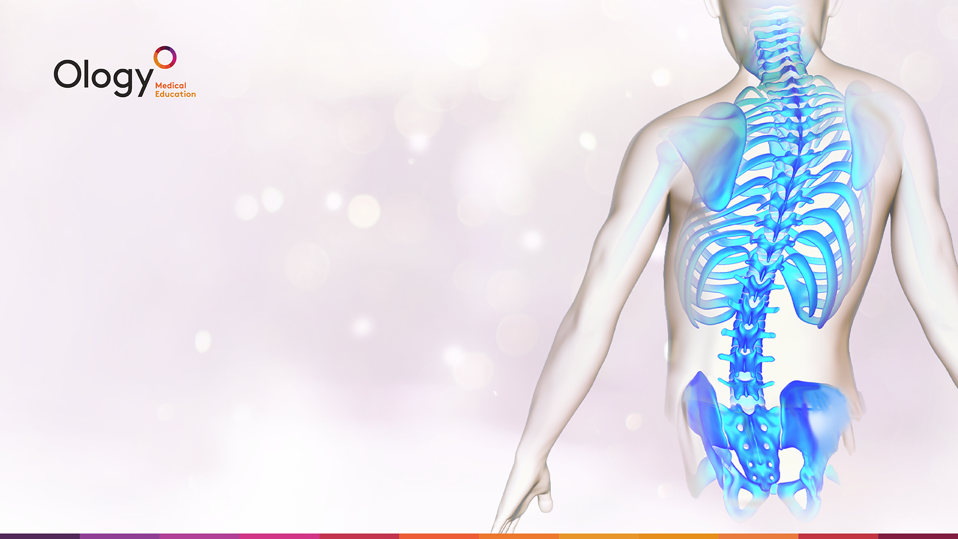 Orthopedic and rehabilitative management of SMA complications | Ology ...